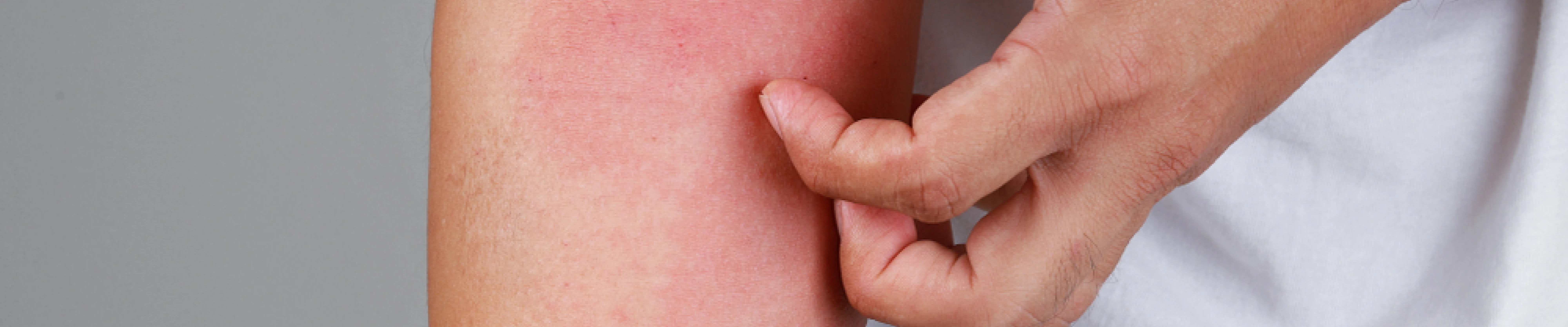 carpet cleaners in Brooklyn, carpet cleaning in Brooklyn, carpet cleaning bkln, carpet cleaners in brooklyn,  commercial carpet cleaning, commercial carpet cleaning in brooklyn,carpet cleaning in brooklyn,  brooklyn rug cleaners, rug cleaning services in brooklyn, same day carpet cleaning, same day rug cleaning